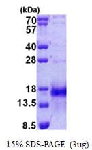 Human IER3 / IEX-1 Protein (Recombinant His)