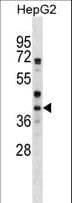 WNT6 Antibody (aa173-201)