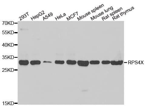RPS4X + RPS4Y1 + RPS Antibody