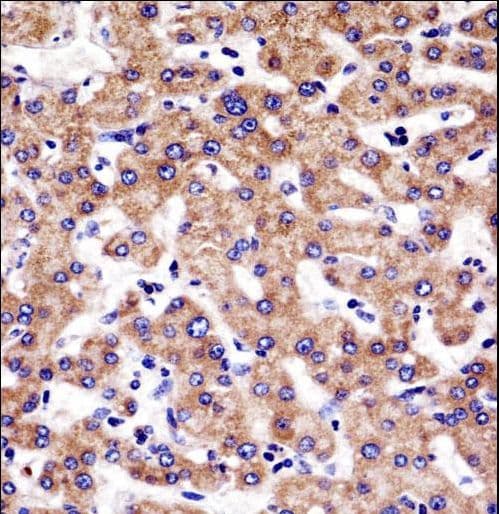 M-PST / STM Antibody (aa67-95)