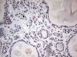 Monoclonal Mouse anti-Human TOP2A / Topoisomerase II Alpha Antibody (clone OTI2D12, aa1100-1531, IHC, WB)