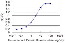 S100A2 Antibody (clone 2D10-A3)
