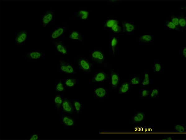 TBL1XR1 / TBLR1 Antibody (clone 3G7)