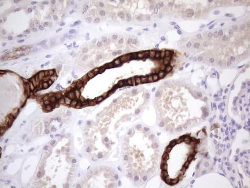 KRT16 / CK16 / Cytokeratin 16 Antibody (clone 7A4, Carrier-free)