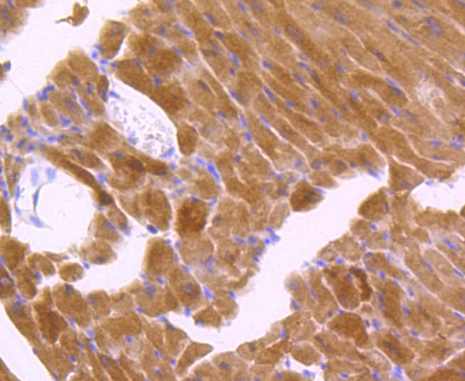 JNK1+2+3 Antibody (JNK1 phospho-Thr183 and JNK2 pThr183 and JNK3 pThr221)
