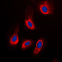 Polyclonal Rabbit anti-Human CASP3 / Caspase 3 Antibody (Internal, IHC, IF, WB)