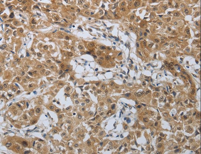 PTPRM / PTP Mu Antibody