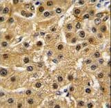 Polyclonal Rabbit anti-Human ABL1 / c-ABL Antibody (aa741-769, IHC, IF, WB)
