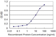 IHC-plus™ GRM1 / MGLUR1 Antibody (clone 1F7)