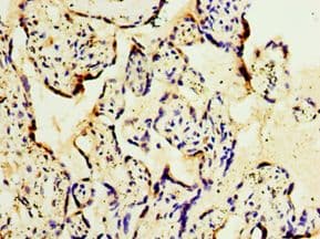 Polyclonal Rabbit anti-Human GS28 / GOSR1 / p28 Antibody (aa1-115, IHC, WB)