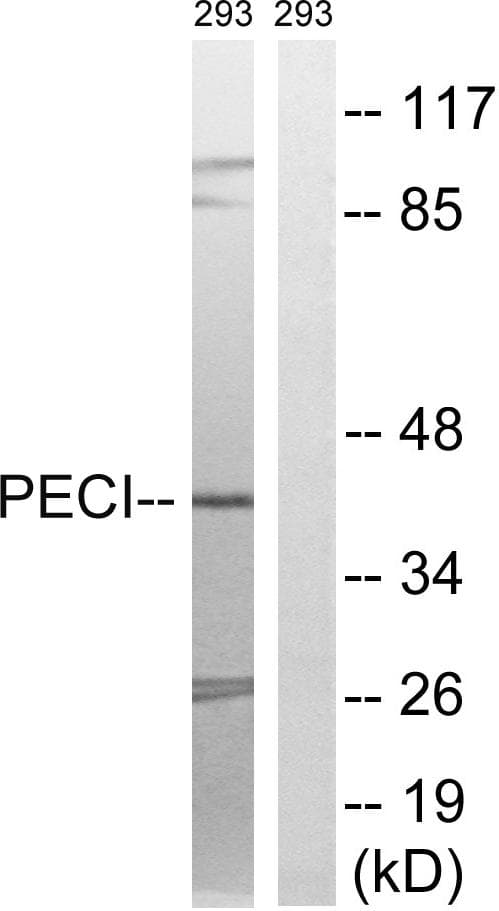 Polyclonal Rabbit anti-Human ECI2 / PECI Antibody (IHC, WB)