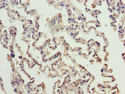 Polyclonal Rabbit anti-Human ERCC6L2 Antibody (IHC)