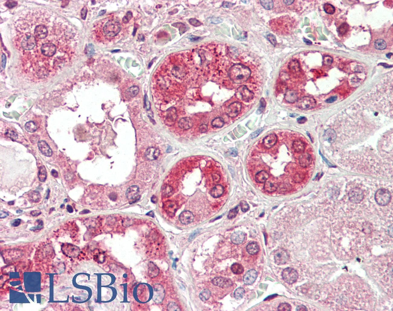 IHC-plus™ Polyclonal Goat anti-Human COG8 Antibody (aa381-393, IHC)