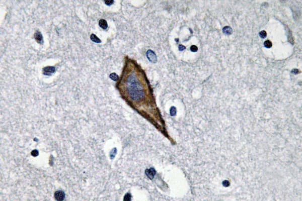 Polyclonal Rabbit anti-Human ANPEP / CD13 Antibody (aa868-917, IHC, WB)