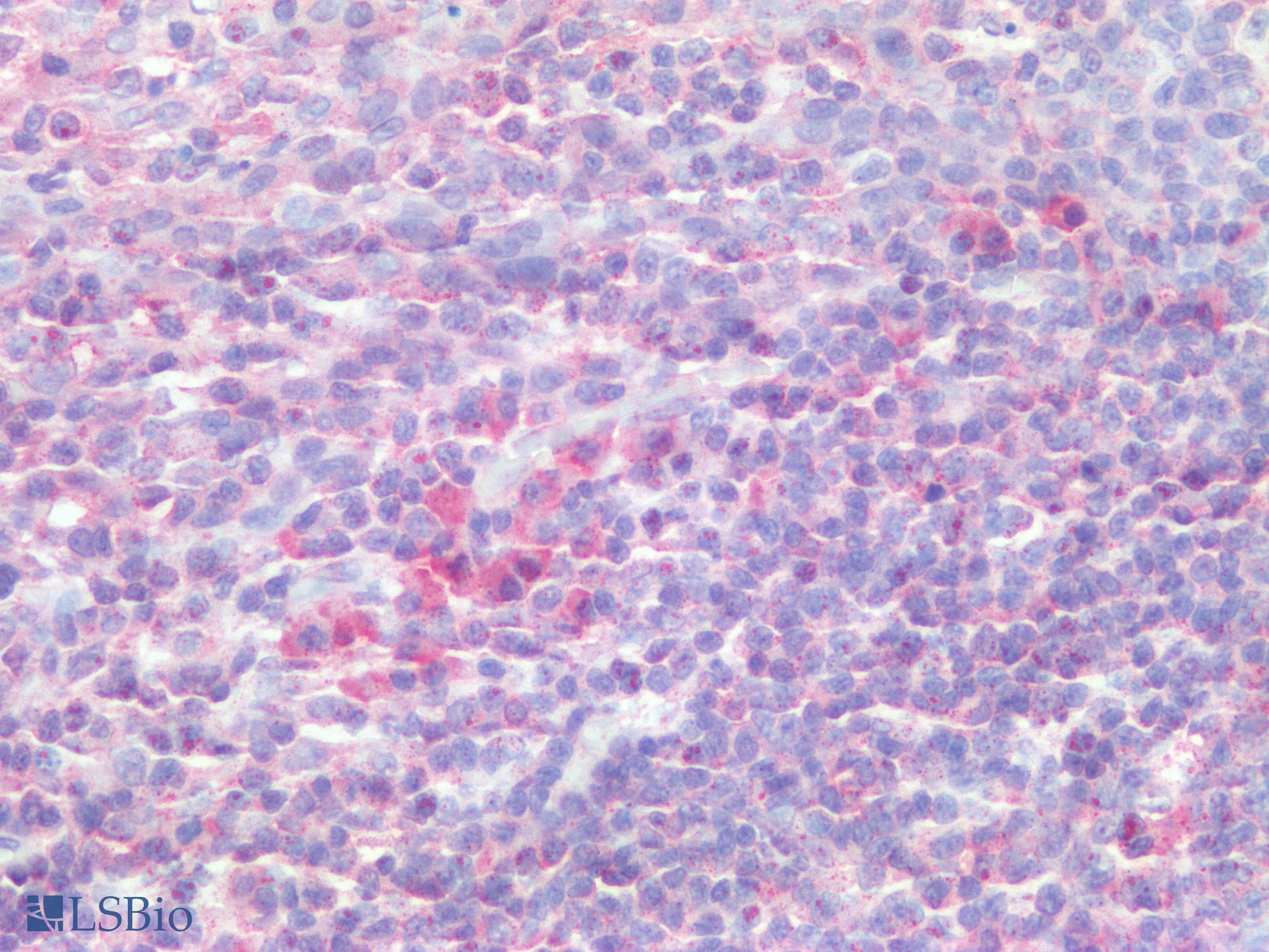 PathPlus™ Polyclonal Rabbit anti-Human c-Kit / CD117 Antibody (Extracellular Domain, IHC)