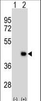 DPPA2 Antibody