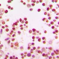 BACH1 Antibody (Internal)