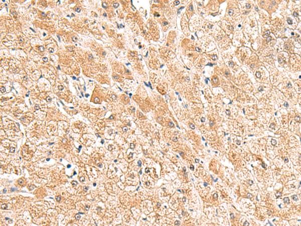 TRUB1 Antibody
