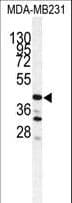 IHC-plus™ CTSS / Cathepsin S Antibody (aa210-240)