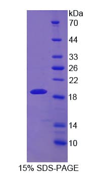 Human DBN1 / Drebrin Protein (Recombinant His)