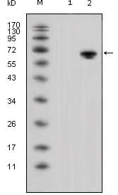 IHC-plus™ WNT5A Antibody (clone 6F2)