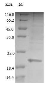 Human PCNA Protein (Recombinant 6His, N-terminus)