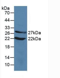 Human CIRP / CIRBP Protein (Recombinant His, N-Terminal)