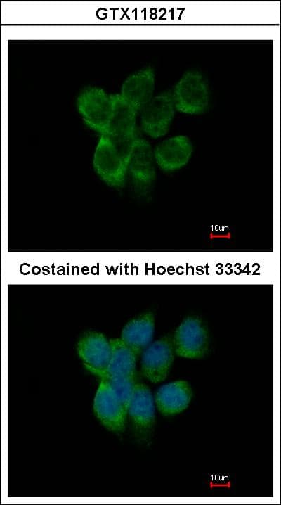 APOBEC3F / ARP8 Antibody