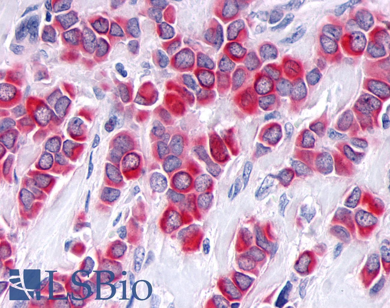 PathPlus™ TNIK Antibody (Internal)