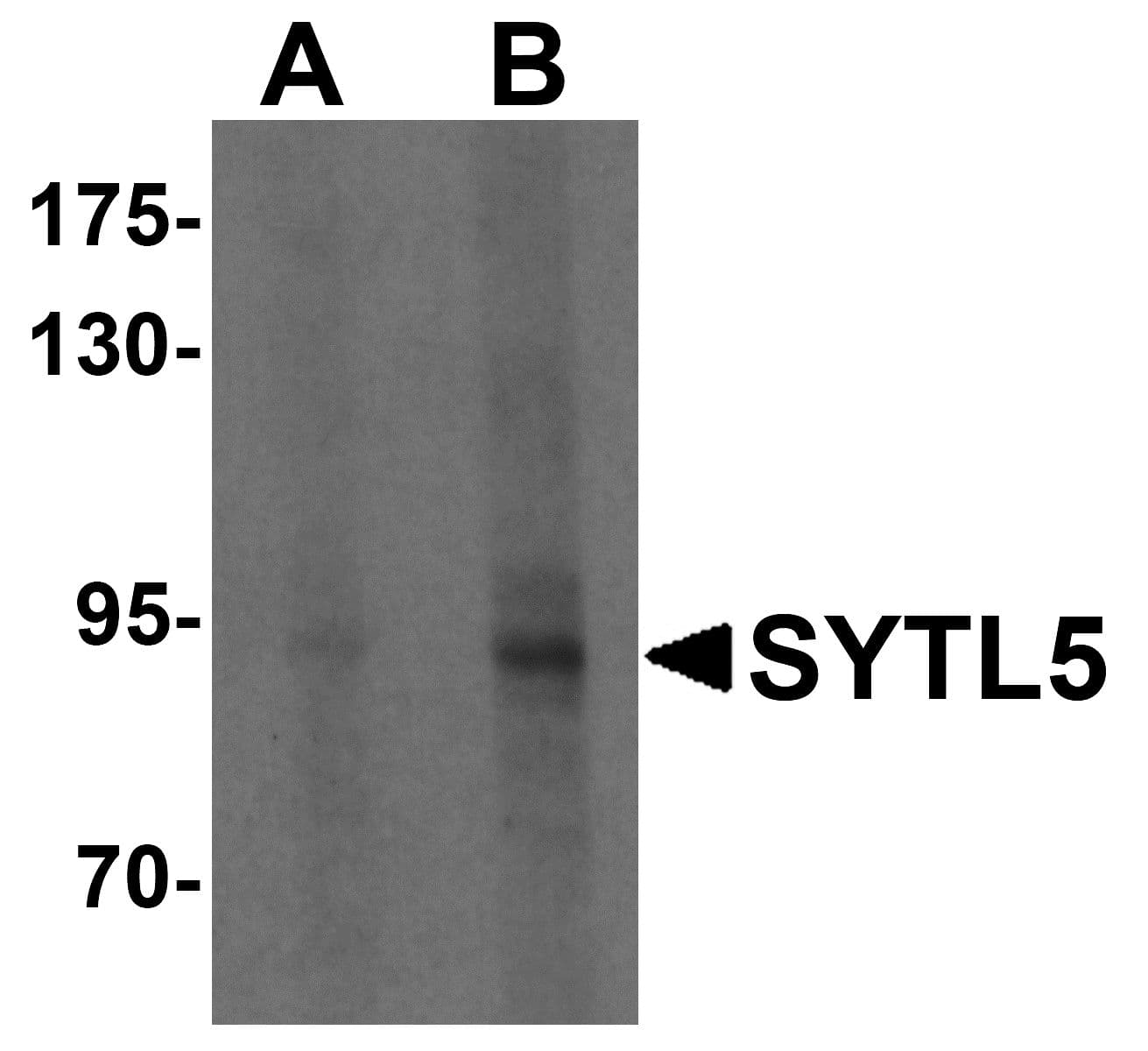 Polyclonal Rabbit anti-Human SYTL5 Antibody (IHC, WB)