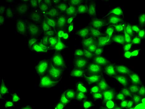 GCK / Glucokinase Antibody