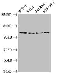 Polyclonal Rabbit anti-Human EPHB3 / EPH Receptor B3 Antibody (IF, WB)