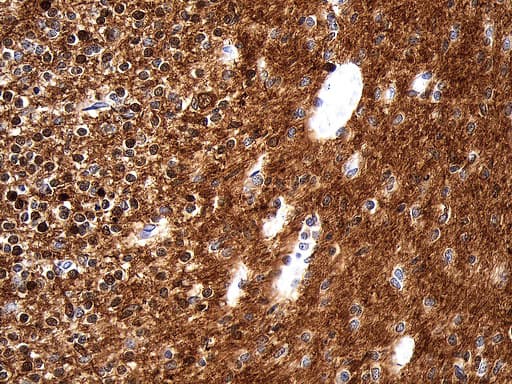 UCHL1 / PGP9.5 Antibody (clone UMAB244)