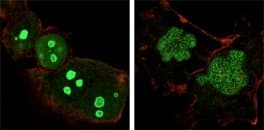 Monoclonal Mouse anti-Human NPM1 / NPM / Nucleophosmin Antibody (clone 7H10B9, IHC, IF, WB)