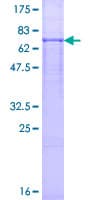 Human LMBR1 Protein (Recombinant GST)