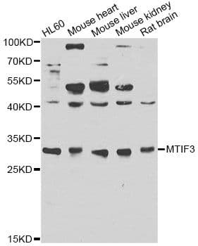 IF3mt / MTIF3 Antibody