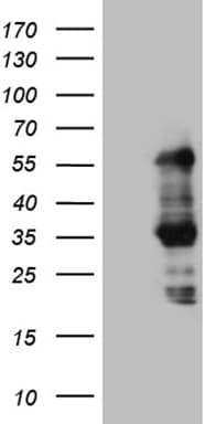 Monoclonal Mouse anti-Human SLC2A4RG / GEF Antibody (clone OTI4B3, aa1-259, WB)