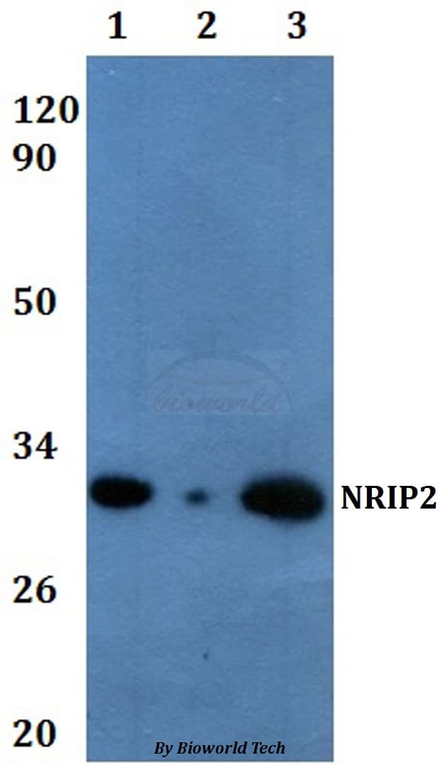 NRIP2 Antibody