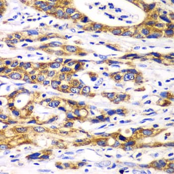 RPN1 / Ribophorin I Antibody