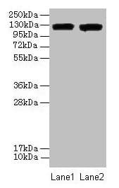 ITGAL / CD11a Antibody
