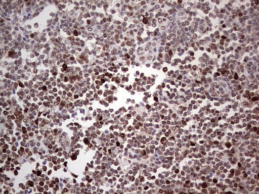 PCNA Antibody (clone OTI13G4)