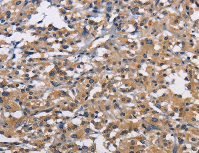 CBY1 / PGEA1 Antibody