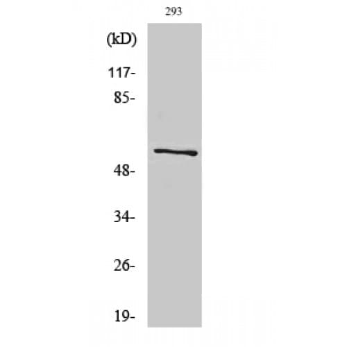 Polyclonal Rabbit anti-Human ATP5A1 / ATP Synthase Alpha Antibody (180-260 aa, Internal, IHC, WB)