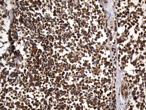 Monoclonal Mouse anti-Human UCHL1 / PGP9.5 Antibody (clone UMAB244, Carrier-free, IHC, WB)