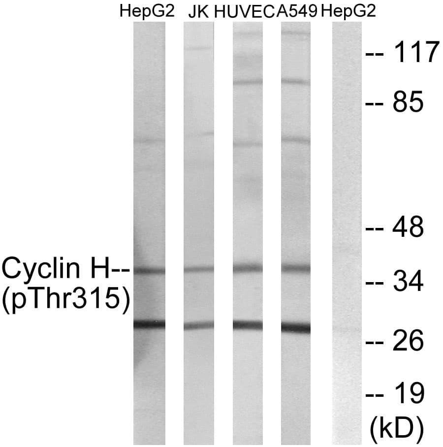 CCNH / Cyclin H Antibody (phospho-Thr315)