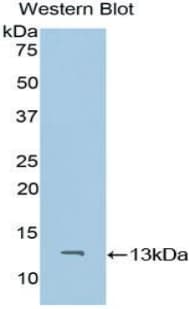 CD59 Antibody (aa26-98)