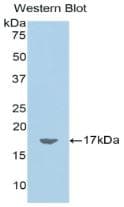 RARRES2 / Chemerin Antibody (aa25-152)