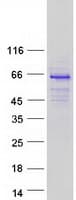 Human AIRE Protein (Recombinant Myc-DDK (Flag))