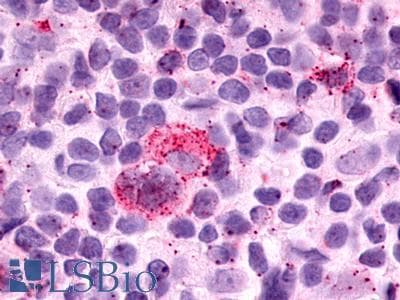 PathPlus™ GPR25 Antibody (C-Terminus)