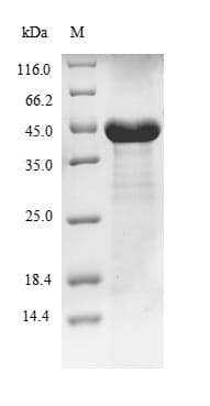 Human PFAS Protein (Recombinant 10His-SUMO, N-terminus + Myc, C-terminus)
